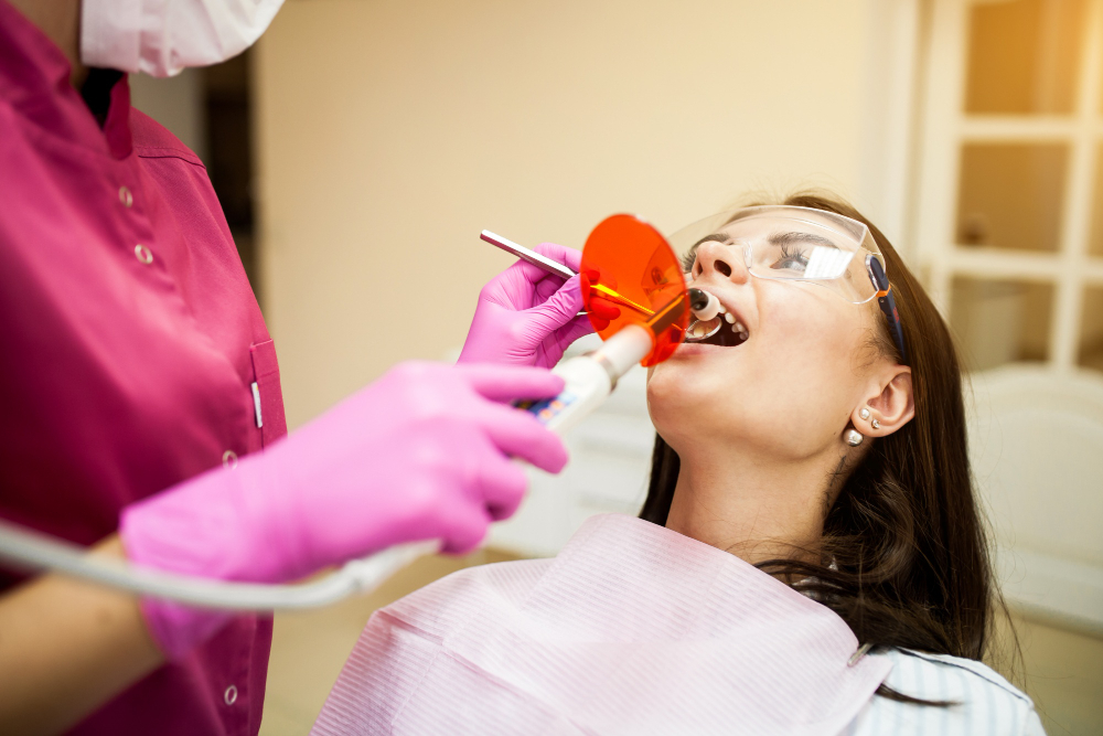 Cavity Fillings
